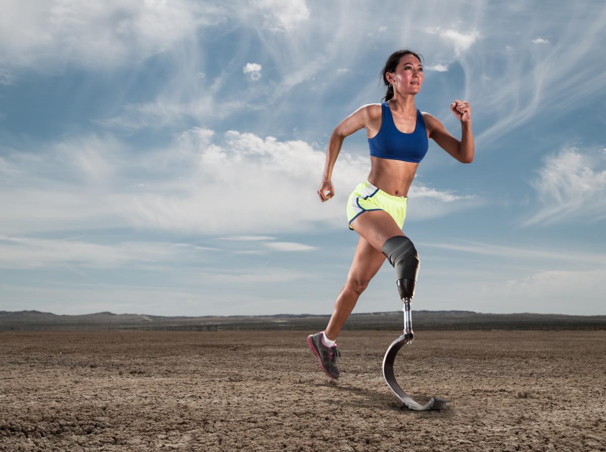Amputee rehabilitation in Bristol